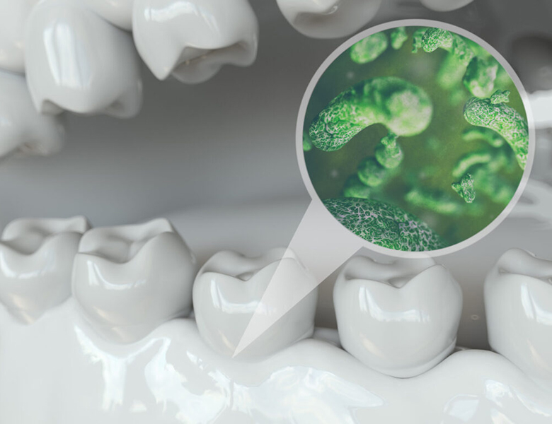 文京区（茗荷谷・江戸川橋）の歯医者、吉澤歯科クリニックの歯周病治療