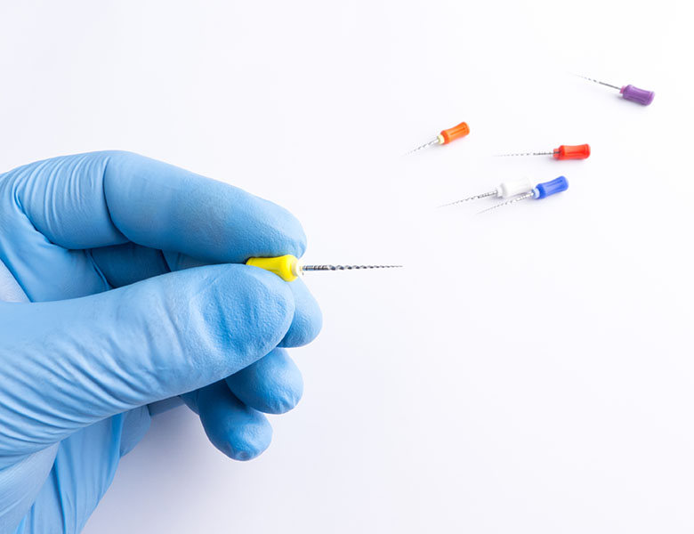 文京区（茗荷谷・江戸川橋）の歯医者、吉澤歯科クリニックの根管治療