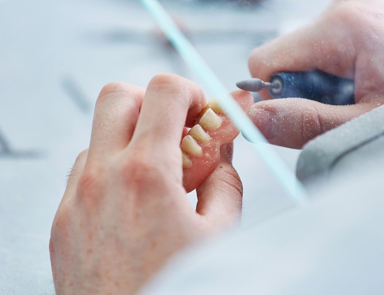 文京区（茗荷谷・江戸川橋）の歯医者、吉澤歯科クリニックの入れ歯治療