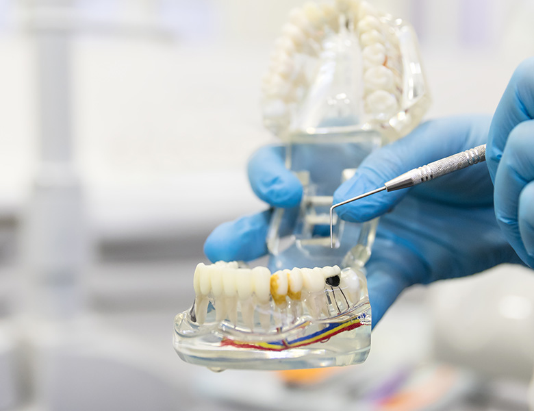 文京区（茗荷谷・江戸川橋）の歯医者、吉澤歯科クリニックの丁寧で解りやすいカウンセリング