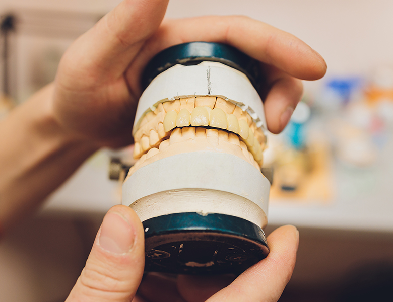 文京区（茗荷谷・江戸川橋）の歯医者、吉澤歯科クリニックのスポーツマウスピース