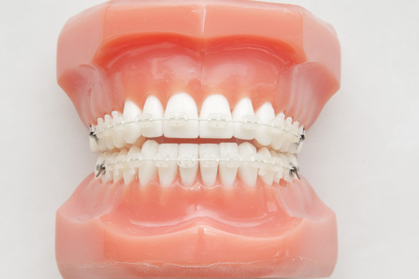 文京区（茗荷谷・江戸川橋）の歯医者、吉澤歯科クリニックの矯正歯科