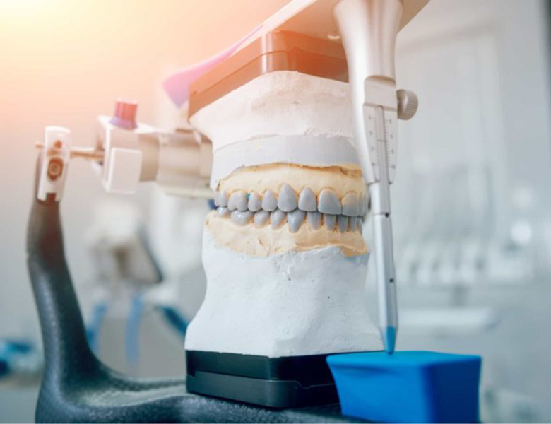 文京区（茗荷谷・江戸川橋）の歯医者、吉澤歯科クリニックの審美歯科治療