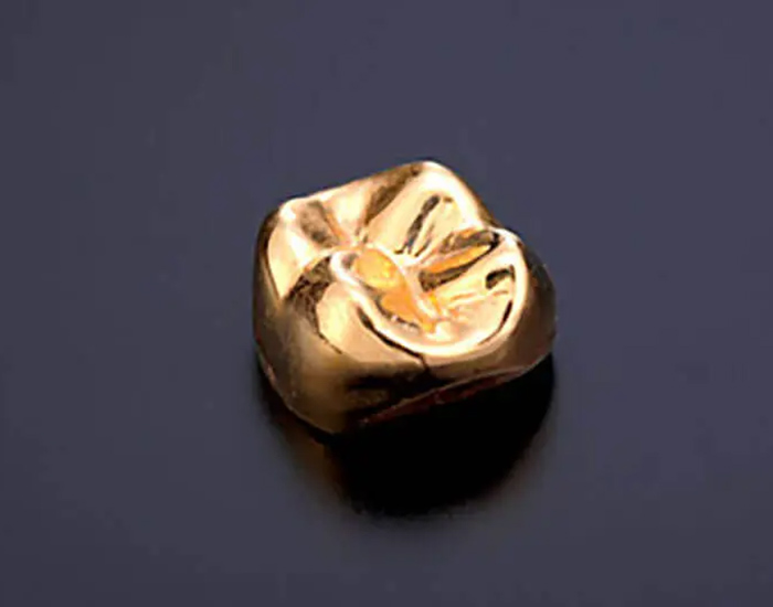 文京区（茗荷谷・江戸川橋）の歯医者、吉澤歯科クリニックの審美歯科治療