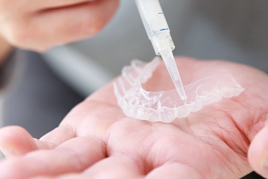 文京区（茗荷谷・江戸川橋）の歯医者、吉澤歯科クリニックのホワイトニング