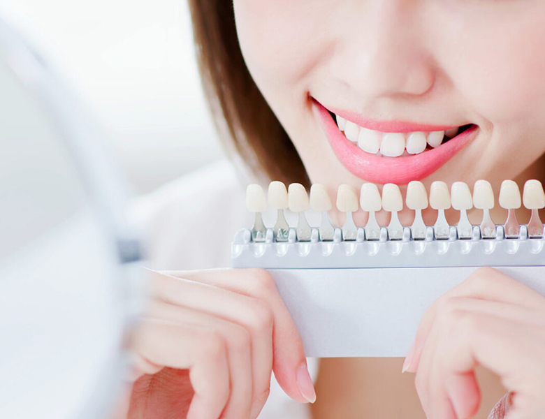 文京区（茗荷谷・江戸川橋）の歯医者、吉澤歯科クリニックのホワイトニング