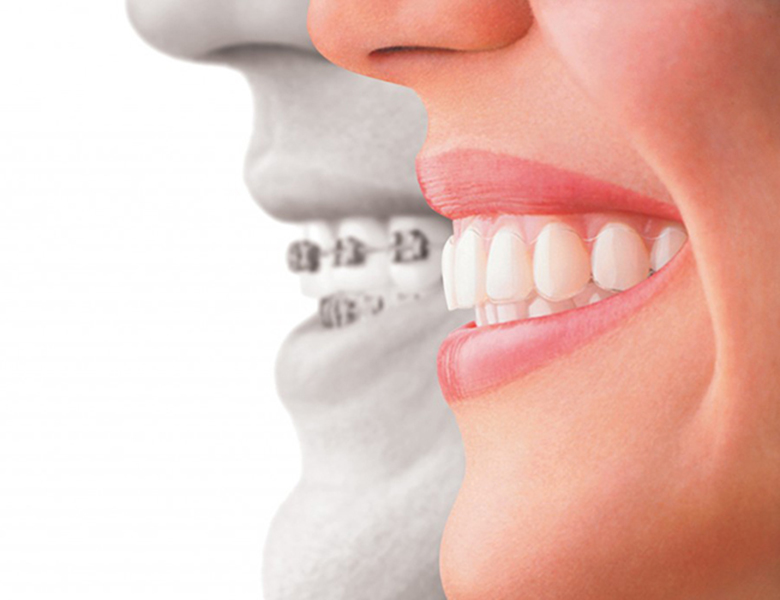 文京区（茗荷谷・江戸川橋）の歯医者、吉澤歯科クリニックの矯正歯科