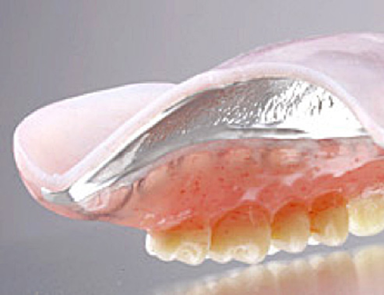 文京区（茗荷谷・江戸川橋）の歯医者、吉澤歯科クリニックの入れ歯治療