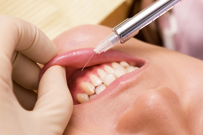 文京区（茗荷谷・江戸川橋）の歯医者、吉澤歯科クリニックの親知らずの抜歯