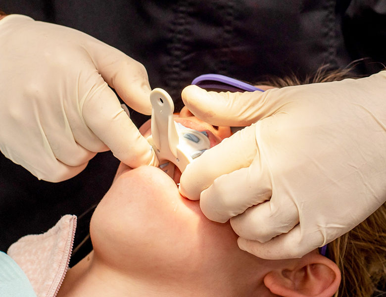 文京区（茗荷谷・江戸川橋）の歯医者、吉澤歯科クリニックの入れ歯治療