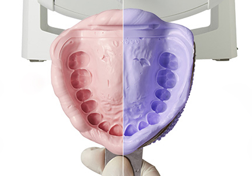 文京区（茗荷谷・江戸川橋）の歯医者、吉澤歯科クリニックの審美歯科治療