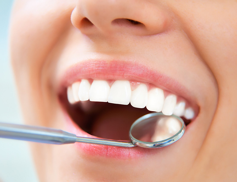 文京区（茗荷谷・江戸川橋）の歯医者、吉澤歯科クリニックの予防歯科