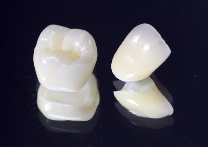 文京区（茗荷谷・江戸川橋）の歯医者、吉澤歯科クリニックの審美歯科治療